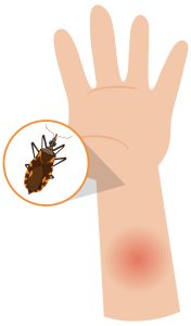 Bed-Bug-Control-Services-in-Gurgaon